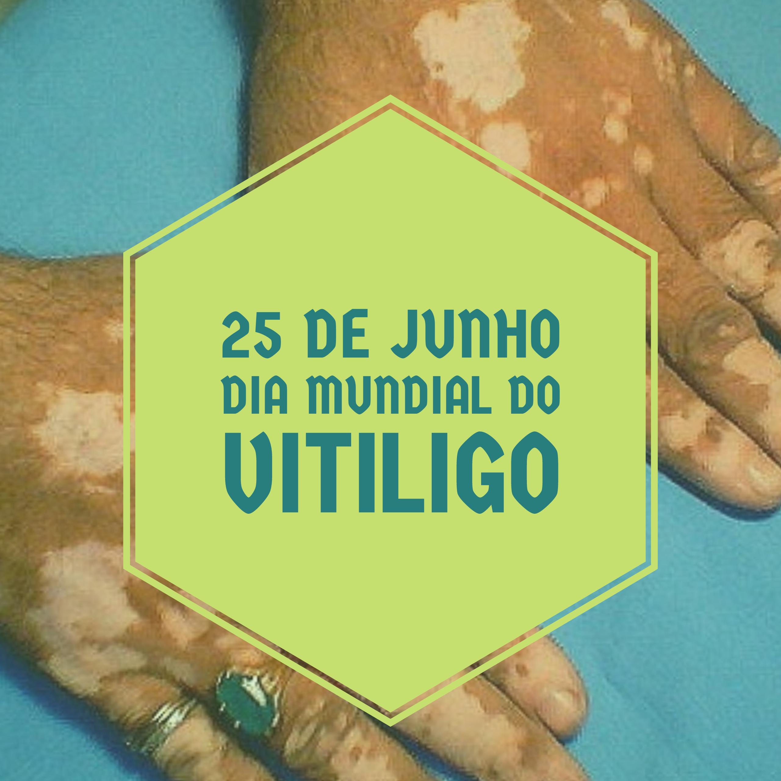 Dia Mundial do Vitiligo