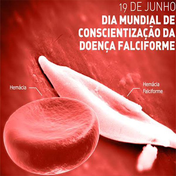 Dia Mundial da Conscientizao da Doena Falciforme